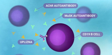 reducing-B-cells-in-gMG
